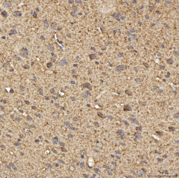 Anti-SPTBN2 Antibody