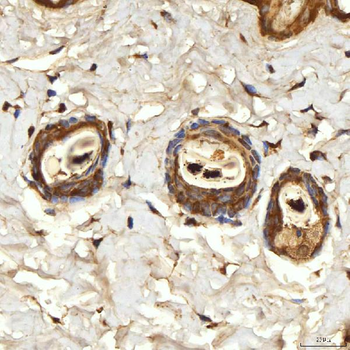 Anti-SPTBN2 Antibody