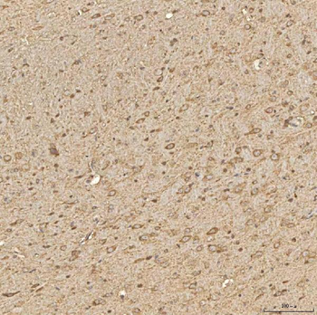 Anti-SPTBN2 Antibody