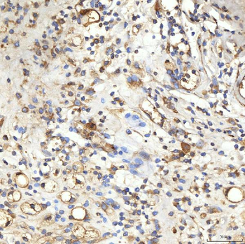 Anti-SPTBN2 Antibody