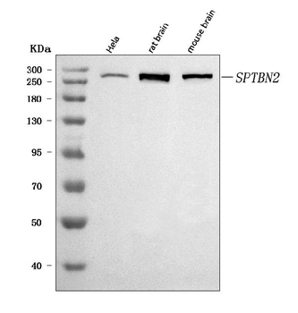 Anti-SPTBN2 Antibody