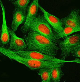 Anti-SPRED2 Antibody
