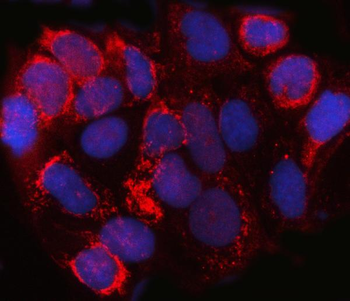 Anti-SPACA3 Antibody