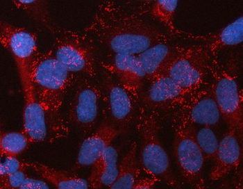 Anti-STON2 Antibody