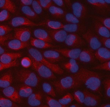Anti-STBD1 Antibody