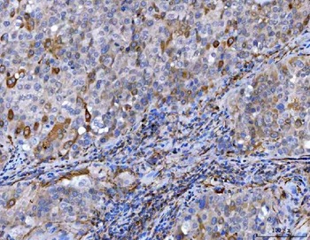 Anti-STBD1 Antibody