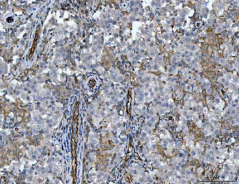 Anti-STBD1 Antibody