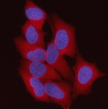 Anti-ST13 Antibody