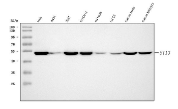 Anti-ST13 Antibody