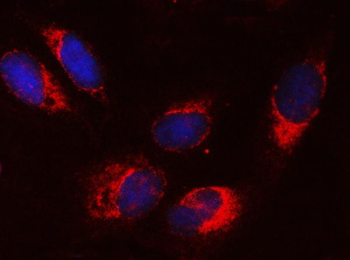 Anti-SRPRA Antibody