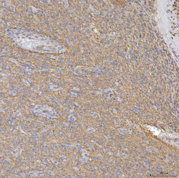 Anti-SRPRA Antibody