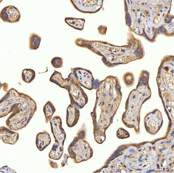 Anti-SRPRA Antibody