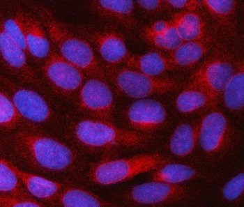 Anti-SRPRB Antibody