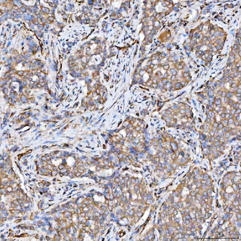 Anti-SRPRB Antibody