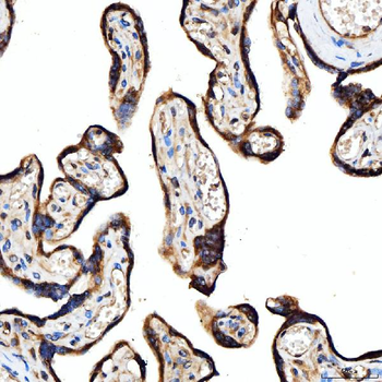 Anti-SRPRB Antibody
