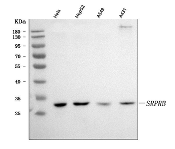 Anti-SRPRB Antibody
