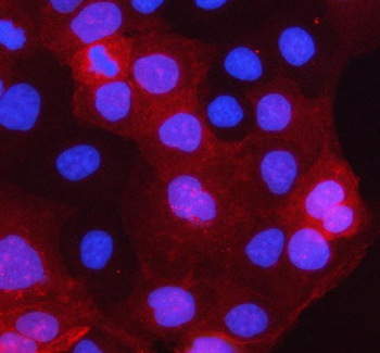 Anti-PCTP-L/STARD10 Antibody