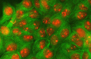 Anti-PSE/SPDEF Antibody