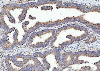 Anti-SPATA18 Antibody