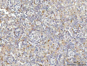 Anti-SPATA18 Antibody