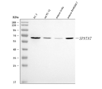 Anti-SPATA7 Antibody
