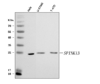 Anti-SPINK13 Antibody