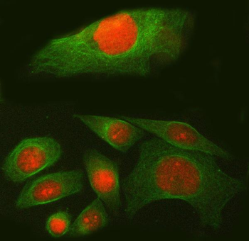 Anti-SPAG7 Antibody