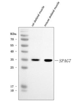 Anti-SPAG7 Antibody