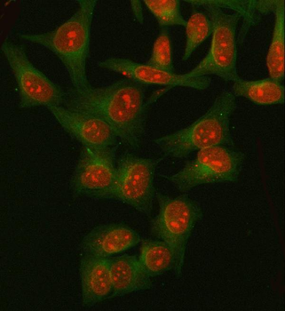 Anti-DNA Ligase IV/LIG4 Antibody