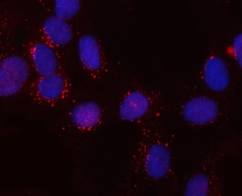 Anti-SNX6 Antibody