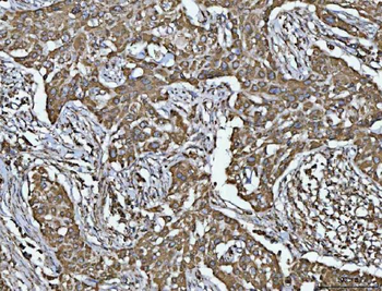 Anti-Porin/VDAC1 Antibody