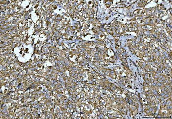 Anti-Porin/VDAC1 Antibody