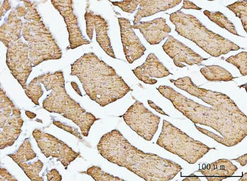 Anti-Porin/VDAC1 Antibody