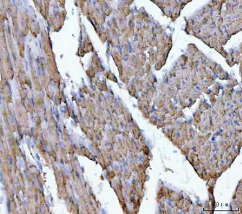 Anti-Porin/VDAC1 Antibody