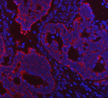 Anti-Porin/VDAC1 Antibody