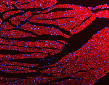 Anti-Porin/VDAC1 Antibody