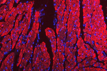 Anti-Porin/VDAC1 Antibody