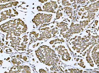 Anti-Porin/VDAC1 Antibody