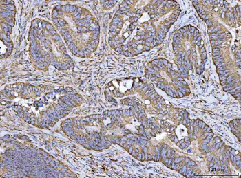 Anti-Porin/VDAC1 Antibody