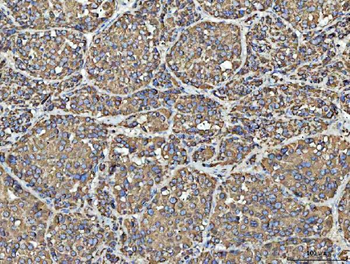 Anti-Porin/VDAC1 Antibody