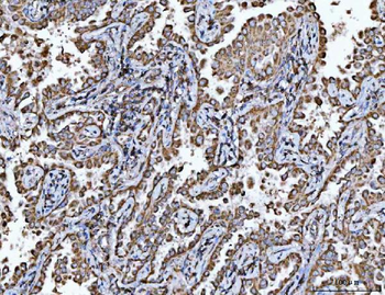 Anti-Porin/VDAC1 Antibody