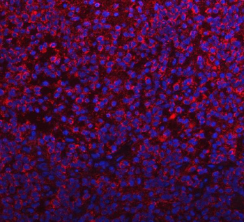 Anti-PYCR1 Antibody