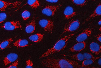 Anti-PYCR1 Antibody