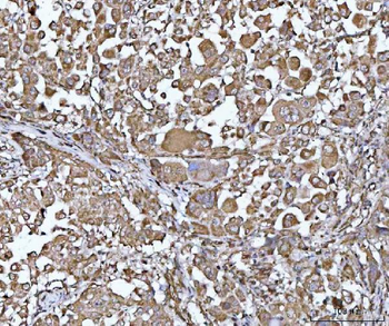 Anti-PYCR1 Antibody