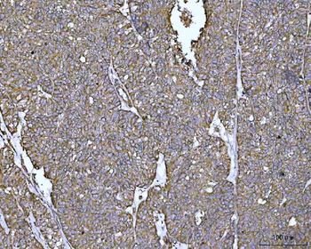 Anti-PYCR1 Antibody