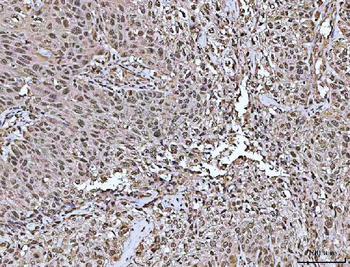 Anti-ASC/TMS1/PYCARD Antibody