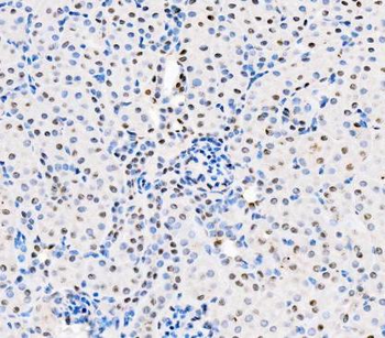 Anti-ASC/TMS1/PYCARD Antibody