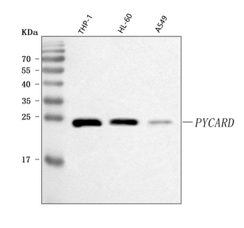 Anti-ASC/TMS1/PYCARD Antibody