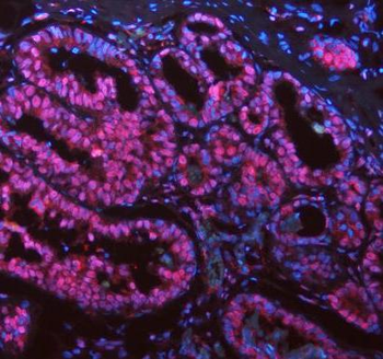 Anti-ASC/TMS1/PYCARD Antibody