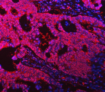 Anti-ASC/TMS1/PYCARD Antibody